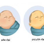 اجاره دستگاه زردی نوزاد بوشهر